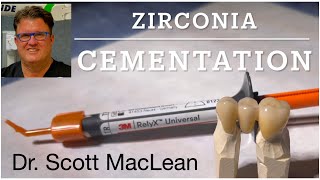 Zirconia Cementation with RelyX Universal Cement  Dr Scott MacLean  Dentist [upl. by Meares]