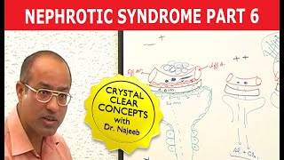 Nephrotic Syndrome  Part 6🩺 [upl. by Boaten]