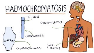 Understanding Haemochromatosis [upl. by Yerggoeg111]