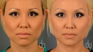 Brow Lift with Botox Hooded Eyes  Where to get Injections amp Avoiding Droop [upl. by Nawd]