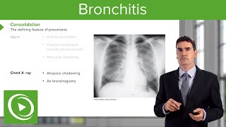 Pulmonary abscess  Respiratory system diseases  NCLEXRN  Khan Academy [upl. by Ledairam4]