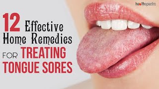 12 Effective Remedies For Treating Tongue Sores  Healthspectra [upl. by Herrera]