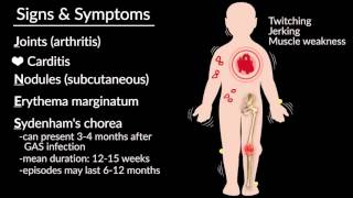 Myocarditis Causes Signs and Symptoms Diagnosis Treatment [upl. by Webster]