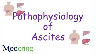 pathophysiology of ascites [upl. by Colburn]