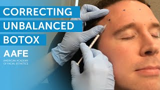 Botox to treat Hyperhidrosis Excessive Sweating  Nashville Injector [upl. by Carolan663]