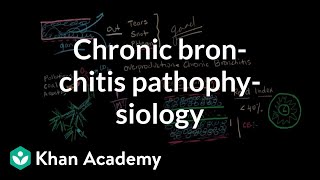 Pathophysiology of spasticity following UMN lesions [upl. by Muraida]