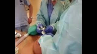 Airway Management During a Difficult Intubation Case [upl. by Eidnim]