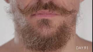 Facial Hair growing for 100 Days in TimeLapse [upl. by Cynthie]