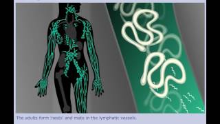 Lymphatic Filariasis Elephantiasis  Life Cycle [upl. by Lednahc]