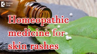 Homeopathic medicine for skin rashes  Dr Surekha Tiwari [upl. by Lynelle]