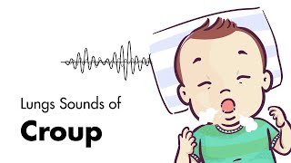 Sounds of Croup Laryngotracheitis  Lung Sounds  MEDZCOOL [upl. by Ytsud]