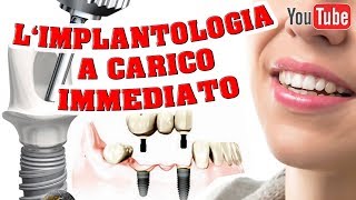 Implantologia A Carico Immediato [upl. by Uhile293]