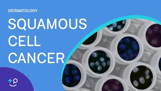 Squamous Cell Cancer Dermatology [upl. by Attenra963]