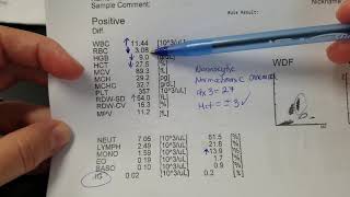 Hematology How to interpret automated Complete Blood Count CBC results [upl. by Sidnak]