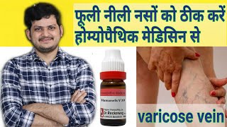 Powerful Homeopathic Medicine for Varicose veins [upl. by Duyne117]