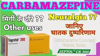 Carbamazepine  Tegretol  Carbamazepine tablets  Tegretol 200 mg  carbamazepine side effect [upl. by Niel]