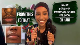 GET RID OF SKIN RASHES ON FACE  Allergic reaction [upl. by Nrobyalc]