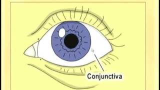 Welcome to NeuroOphthalmology with Dr Andrew G Lee [upl. by Chemash]