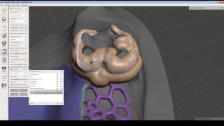 Come creare elementi complessi per odontoiatria con Autodesk Meshmixer [upl. by Ennaisoj623]