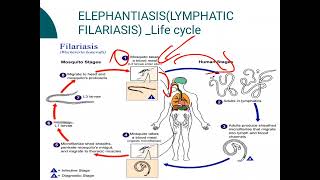 ElephantiasisLYMPHATIC FILARIASIS [upl. by Larisa36]