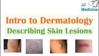 Introduction to Dermatology  The Basics  Describing Skin Lesions Primary amp Secondary Morphology [upl. by Ahtekahs]