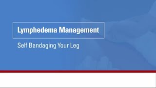 Top 3 Exercises for Leg Lymphedema Swelling or Edema [upl. by Edwin]