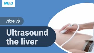 How to ultrasound the liver [upl. by Derek]