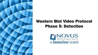 Western Blot Visual Protocol Phase 5 Detection [upl. by Denise31]