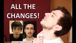 FTM Trans Guy Everything Testosterone Changes [upl. by Onitsoga792]