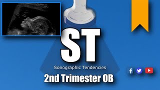 2nd Trimester OB scan [upl. by Eelahc]