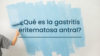 ¿Qué es la Gastritis eritematosa antral [upl. by Atiner]