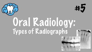 Oral Radiology  Types of Radiographs  INBDE ADAT [upl. by Ojyram708]