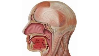 SQUAMOUS CELL CARCINOMA Clinical features amp Morphology Premalignant lesions [upl. by Ailama]