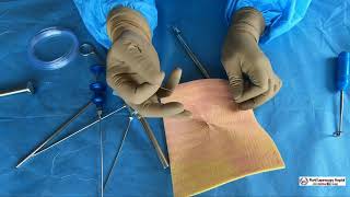 Upper GI Endoscopy Procedure in the ED [upl. by Vidda518]