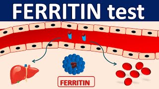 Serum Ferritin test  Its role in inflammation [upl. by Akcinehs]