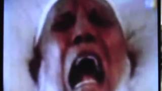 Ahmed Deedat Horrific End YouTube [upl. by Rozalie]