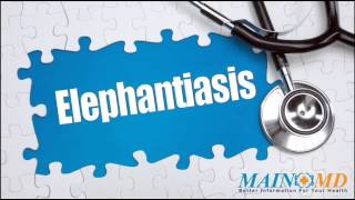 Elephantiasis ¦ Treatment and Symptoms [upl. by Cob]