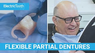 Flexible dentures amp false teeth explained [upl. by Heiney]