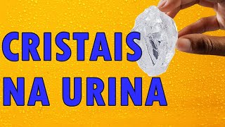 CRISTAL na URINA NÃO é PEDRA e Não DÓI [upl. by Vivyan757]