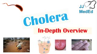 Cholera Vibrio Cholerae Pathophysiology Risk Factors Symptoms Diagnosis and Treatment [upl. by Sido591]