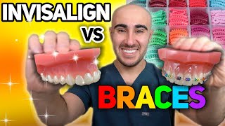 Invisalign Pros and Cons [upl. by Essirehs558]