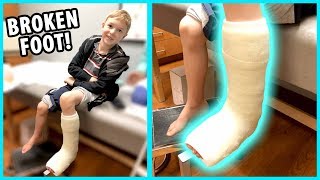 Getting a Cast Jacob Broke His Foot  Part 2 [upl. by Ezmeralda]