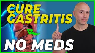 HOW to CURE GASTRITIS without medications  DR CARLOS [upl. by Anwahsad379]