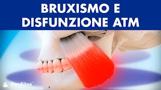 Bruxismo e disfunzione articolazione temporomandibolare © [upl. by Krystalle]