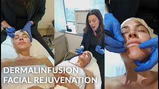 DERMALINFUSION LIVE Treatment  SilkPeel  Microdermabrasion  Dr Jason Emer [upl. by Reyna707]