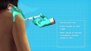 Administering a Deltoid Injection  Jones amp Bartlett Learning [upl. by Ahsaenat504]