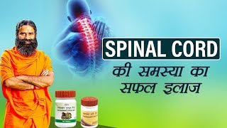 Ayurvedic treatment for Slip Disc  Dr Prashanth S Acharya [upl. by Affer242]