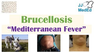 Brucellosis Mediterranean Fever  Transmission Pathogenesis Symptoms Diagnosis Treatment [upl. by Eskill]