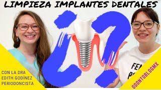 LIMPIEZA DE IMPLANTES DENTALES 🦷 con Dra Edith Godínez Padilla [upl. by Llerrehs]