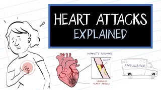 Signs and symptoms of a heart attack [upl. by Atsirhcal817]